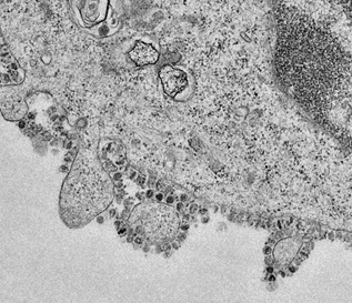 Coronavirus microscopic view
