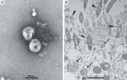 Covid19 microscopic view